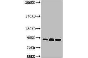 Western blot analysis of 1) Hela, 2) Mouse Brain tissue, 3) Rat Brain tissue, diluted at 1:2000. (HSP9AB1 antibody)