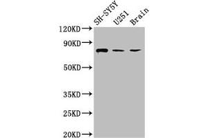 Western Blot Positive WB detected in: SH-SY5Y whole cell lysate, U251 whole cell lysate, Rat brain tissue All lanes: NCDN antibody at 2.
