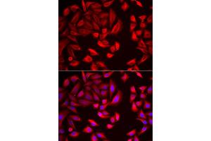 Immunofluorescence analysis of HeLa cells using CCT2 antibody (ABIN5973929). (CCT2 antibody)