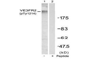 Image no. 2 for anti-VEGF Receptor 2 (VEGFR2) (pTyr1214) antibody (ABIN196769) (VEGFR2/CD309 antibody  (pTyr1214))