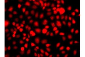 Immunofluorescence analysis of A549 cells using NR2E1 antibody (ABIN6290680). (NR2E1 antibody)