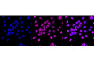 Immunocytochemical staining of HepG2 cells with Phospho-IKB alpha (S32) antibody (ABIN7799639), 1:1,000).
