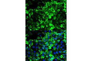 Immunofluorescence analysis of HeLa cell using TPM1 antibody. (Tropomyosin antibody)