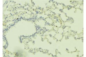 ABIN6275930 at 1/100 staining Human lung tissue by IHC-P.