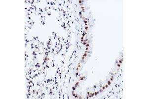Immunohistochemistry of paraffin-embedded mouse lung using p73 Rabbit mAb (ABIN1678945, ABIN1678944, ABIN7101487 and ABIN7101488) at dilution of 1:100 (40x lens). (Tumor Protein p73 antibody)