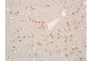 Formalin-fixed and paraffin embedded rat brain labeled with Rabbit Anti Hes5 Polyclonal Antibody, Unconjugated (ABIN703811) at 1:200 followed by conjugation to the secondary antibody and DAB staining
