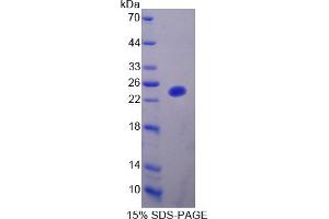 Image no. 1 for Sex Hormone Binding Globulin (SHBG) (AA 44-222) protein (His tag) (ABIN4988415)