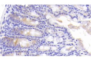 Detection of ICK in Mouse Colon Tissue using Polyclonal Antibody to Intestinal Cell Kinase (ICK) (ICK antibody  (AA 1-284))