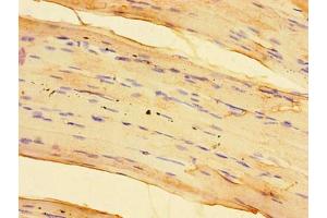 Immunohistochemistry of paraffin-embedded human skeletal muscle tissue using ABIN7170581 at dilution of 1:100 (SPHK1 antibody  (AA 1-384))