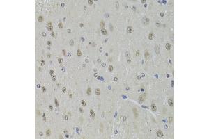 Immunohistochemistry of paraffin-embedded mouse brain using DDX1 Antibody (ABIN5973950) at dilution of 1/100 (40x lens). (DDX1 antibody)