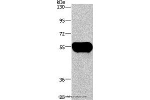 Western blot analysis of Human plasma tissue, using AHSG Polyclonal Antibody at dilution of 1:1350 (Fetuin A antibody)