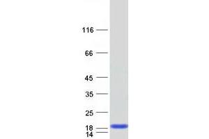 Validation with Western Blot (FABP6 Protein (Transcript Variant 2) (Myc-DYKDDDDK Tag))