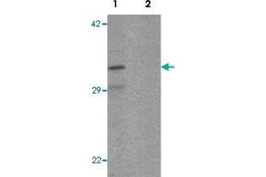 Western blot analysis of K562 cell lysate with CLEC2A polyclonal antibody  at 1 ug/mL in (1) the absence and (2) the presence of blocking peptide. (CLEC2A antibody  (N-Term))