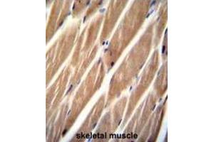 Immunohistochemistry (IHC) image for anti-Phosphatidylinositol-4-Phosphate 5-Kinase-Like 1 (PIP5KL1) antibody (ABIN2996126) (PIP5KL1 antibody)