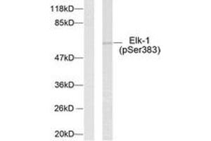 Western blot analysis of extracts from HeLa cells treated with UV, using Elk1 (Phospho-Ser383) Antibody. (ELK1 antibody  (AA 351-400))