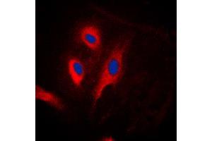 Immunofluorescent analysis of FADD staining in HeLa cells. (FADD antibody  (Center))