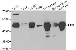 Western blot analysis of extracts of various cell lines, using HPD antibody. (HPD antibody)