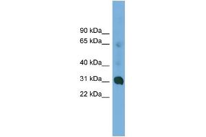 WB Suggested Anti-CCDC127 Antibody Titration: 0. (CCDC127 antibody  (N-Term))