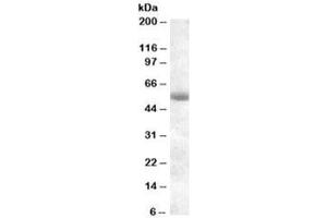Western blot testing of human pancreas lysate with TMPRSS2 antibody at 0. (TMPRSS2 antibody)