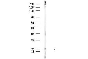 anti-Ribosomal Protein L17 (RPL17) (C-Term) antibody