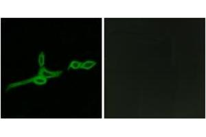 Immunofluorescence analysis of LOVO cells, using GPR15 Antibody. (GPR15 antibody  (AA 201-250))