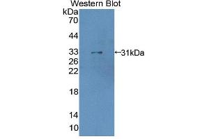 Figure. (LDOC1 antibody  (AA 1-146))
