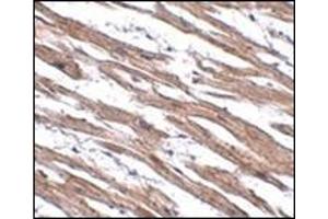 Immunohistochemistry of MAK10 in human heart tissue with this product at 2. (MAK10/NAA35 antibody  (N-Term))