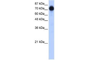 WB Suggested Anti-ZNF16 Antibody Titration:  0. (ZNF16 antibody  (N-Term))