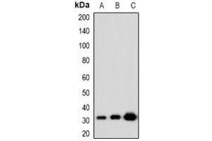 Western blot analysis of KLF13 (AcK166) expression in HeLa (A), NIH3T3 (B), PC12 (C) whole cell lysates.