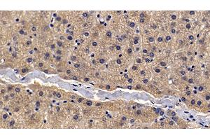 Immunohistochemistry (IHC) image for anti-alpha-2-Macroglobulin (A2M) (AA 616-856) antibody (ABIN7429073)