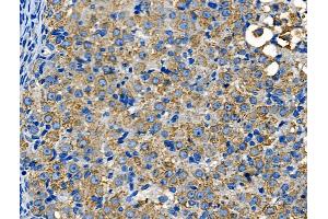ABIN6260501 and ABIN6268729 at 1/100 staining Rat ovarian tissue by IHC-P.