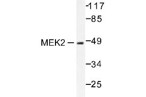 Image no. 1 for anti-Mitogen-Activated Protein Kinase Kinase 2 (MAP2K2) antibody (ABIN265519) (MEK2 antibody)