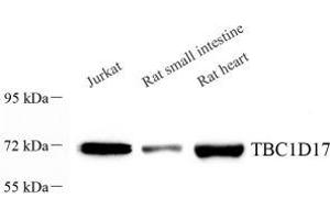 Western blot analysis of TBC1D17 (ABIN7075844) at dilution of 1: 1000 (TBC1D17 antibody)