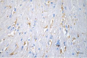Immunohistochemistry was performed on paraffin-embedded mouse brain using desmin antibody (ABIN7798314), 1:200). (Recombinant Desmin antibody)