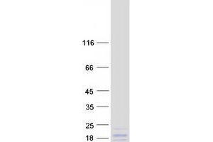 Validation with Western Blot