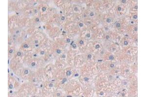 Detection of PLCg1 in Human Liver Tissue using Polyclonal Antibody to Phospholipase C Gamma 1 (PLCg1) (Phospholipase C gamma 1 antibody  (AA 1091-1290))