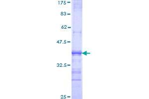 Sortilin 1 Protein (SORT1) (AA 203-299) (GST tag)