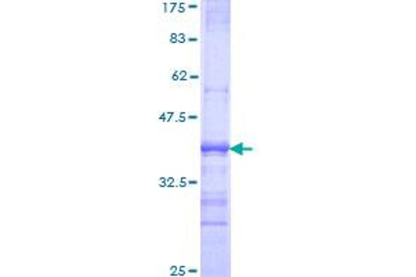 Sortilin 1 Protein (SORT1) (AA 203-299) (GST tag)