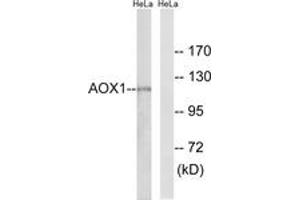 Western blot analysis of extracts from HeLa cells, using AOX1 Antibody. (AOX1 antibody  (AA 521-570))