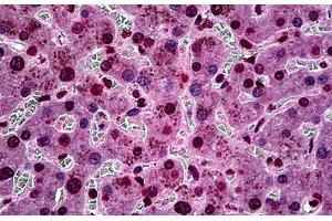 Immunohistochemistry (Formalin-fixed Paraffin-embedded Sections) (IHC (fp)) image for anti-serum/glucocorticoid Regulated Kinase 1 (SGK1) (AA 1-91) antibody (ABIN626173)