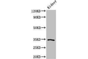 Western Blot Positive WB detected in: Mouse kidney tissue All lanes: KLF7 antibody at 3 μg/mL Secondary Goat polyclonal to rabbit IgG at 1/50000 dilution Predicted band size: 34, 30, 25, 31, 14, 10 kDa Observed band size: 34 kDa (KLF7 antibody  (AA 114-220))
