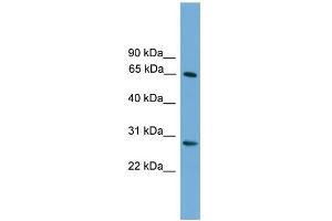 WB Suggested Anti-FBXW8 Antibody Titration: 0. (FBXW8 antibody  (Middle Region))