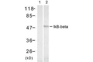 Western blot analysis of extract from 293 cells treated with TNF-α, using IκB-β (Ab-23) antibody (E021304, Lane 1 and 2). (NFKBIB antibody)