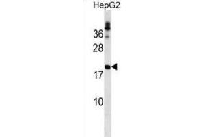 Western Blotting (WB) image for anti-Lipoma HMGIC Fusion Partner (LHFP) antibody (ABIN2999873) (LHFP antibody)