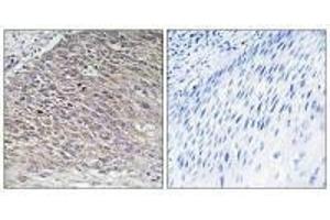 Immunohistochemistry analysis of paraffin-embedded human testis tissue using MAST4 antibody. (MAST4 antibody)