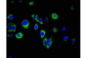 Immunofluorescent analysis of A549 cells using ABIN7157739 at dilution of 1:100 and Alexa Fluor 488-congugated AffiniPure Goat Anti-Rabbit IgG(H+L) (SPINT2 antibody  (AA 71-194))