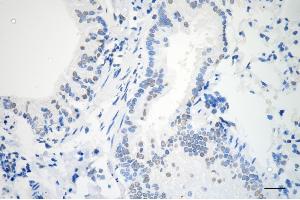 Immunohistochemistry was performed on paraffin-embedded mouse lung using AKAP8 antibody (ABIN7797435), 1:200).