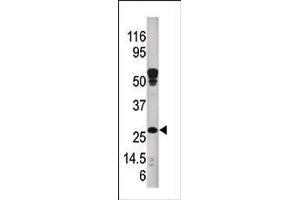 Western blot analysis of anti-ABAD Pab in mouse kidney tissue lysate. (HSD17B10 antibody  (C-Term))