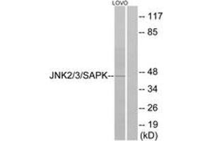 Western blot analysis of extracts from LOVO cells, using SAPK/JNK (Ab-183) Antibody.