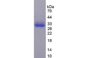 SDS-PAGE analysis of Human TRADD Protein. (TRADD Protein)
